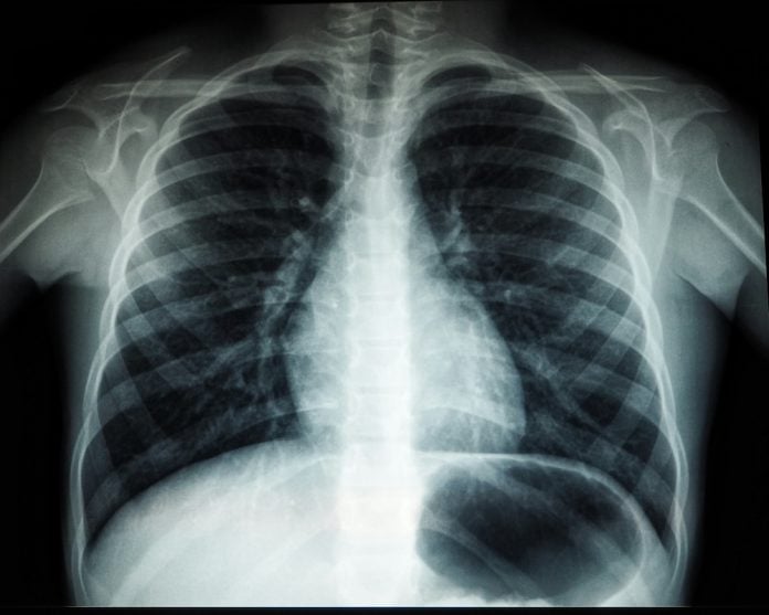 X ray image